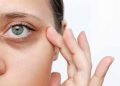 How to Get Rid of Dark Circles Naturally: A Step-by-Step Guide for 2026