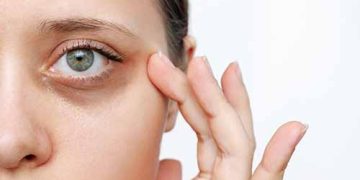 How to Get Rid of Dark Circles Naturally: A Step-by-Step Guide for 2026
