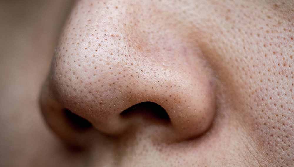 How to Get Rid of Blackheads on Your Nose A Step by Step Guide for 2026 1