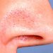 How to Get Rid of Blackheads on Your Nose: A Step-by-Step Guide for 2026